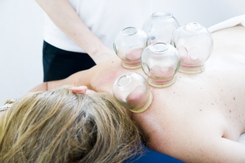 Ventosas o Cupping
